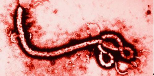 伊波拉病毒国语在线观看,生死边缘的惊悚对决